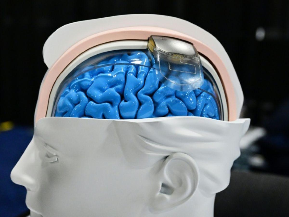 Révolution Discrète des Neurotechnologies en Science-Fiction Révolution Discrète des Neurotechnologies en Science-Fiction