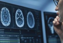 IRM Cérébrale: IA Améliore Détection des Anomalies IRM Cérébrale: IA Améliore Détection des Anomalies