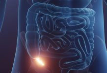 Efficacité des antibiotiques pour traiter l’appendicite Efficacité des antibiotiques pour traiter l'appendicite