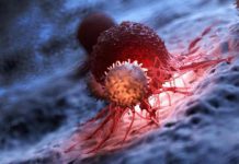 ارتفاع مستوى الكوليسترول في الدم بزيد عدوانية سرطان المثانة ارتفاع مستوى الكوليسترول في الدم بزيد عدوانية سرطان المثانة