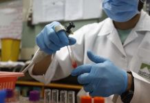 مصر تسجل إصابة رابعة بفيروس جدري القرود مصر تسجل إصابة رابعة بفيروس جدري القرود