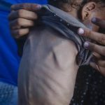 UN Report Warns of Deepening Hunger Crisis in 16 Hotspots UN Report Warns of Deepening Hunger Crisis in 16 Hotspots