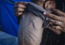 UN Report Warns of Deepening Hunger Crisis in 16 Hotspots UN Report Warns of Deepening Hunger Crisis in 16 Hotspots