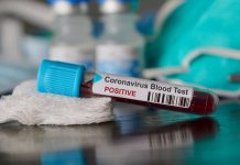 Majority of Kenyans extremely worried about Covid-19 situation, study reveals