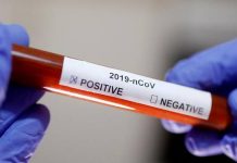 Wajir County opens regional Covid-19 testing centre