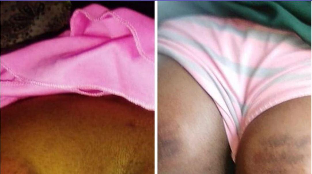 Ncabaneni High students rushed to hospital after being assaulted by Headteacher Dalton Kunene Ncabaneni High students rushed to hospital after being assaulted by Headteacher Dalton Kunene