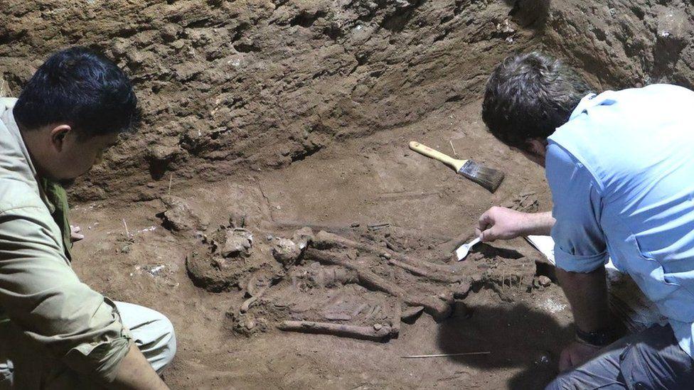 Earliest evidence of amputation found in Indonesia cave Earliest evidence of amputation found in Indonesia cave