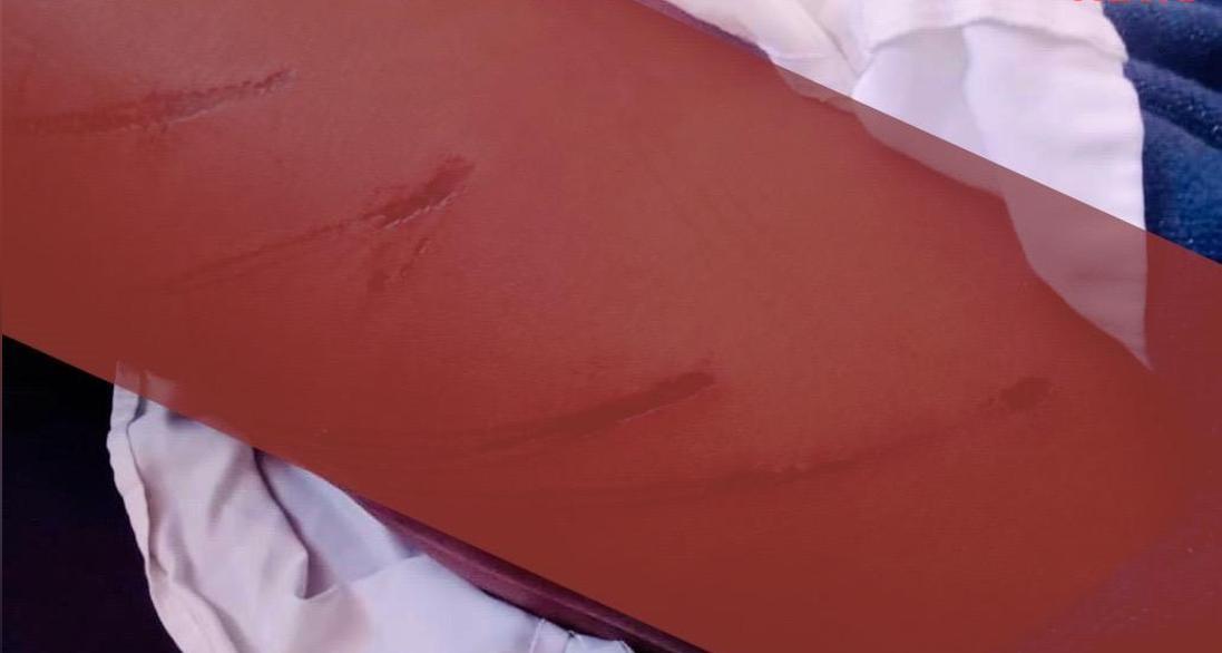 Hhukwini Community Police(Emaphoyisa Emmango), Heavily Assault Sixteen(16) Year-Old Boy for Allegedly Breaking into Ex-Mp Saladin Magagula’S Grocery Shop,Suspect in a Critical Condition at Mbabane Government Hospital Hhukwini Community Police(Emaphoyisa Emmango), Heavily Assault Sixteen(16) Year-Old Boy for Allegedly Breaking into Ex-Mp Saladin Magagula’S Grocery Shop,Suspect in a Critical Condition at Mbabane Government Hospital