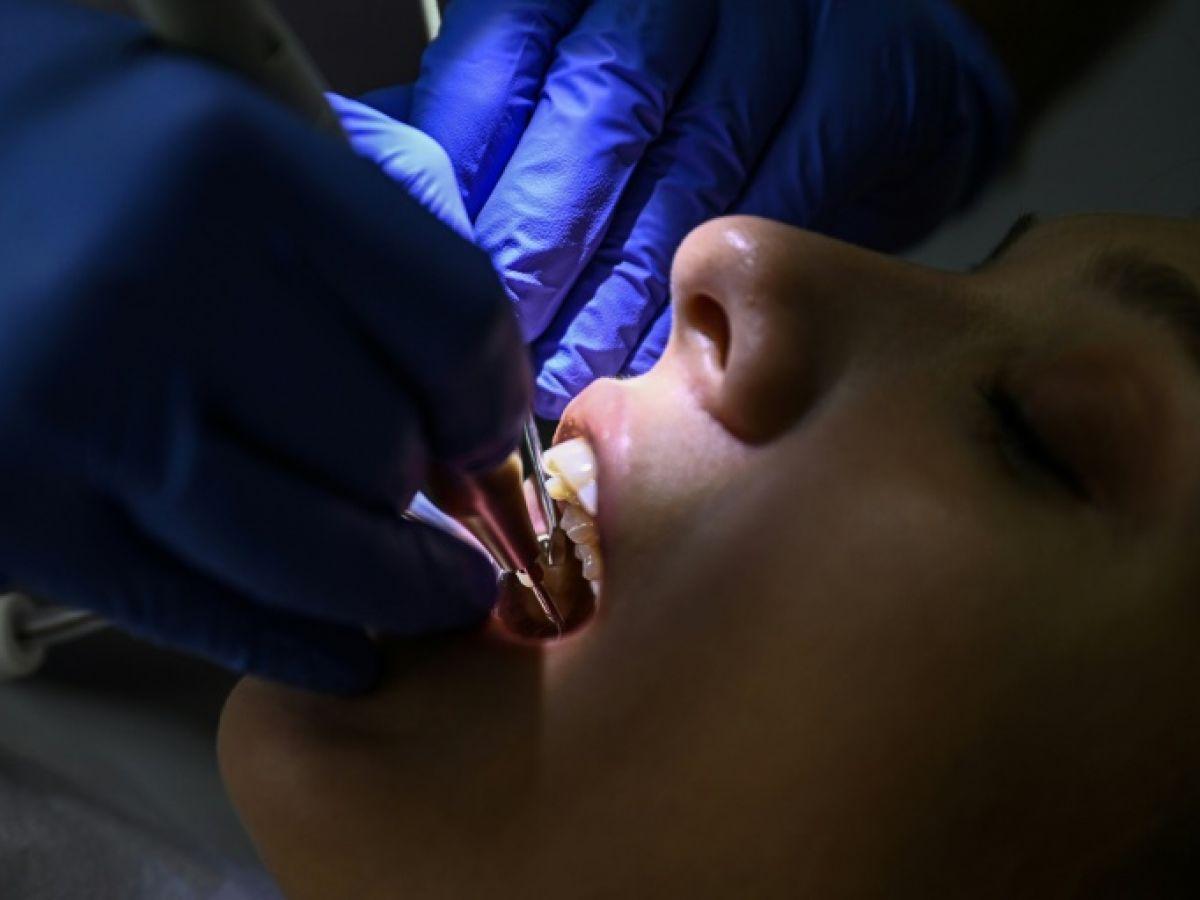 Les maladies bucco-dentaires touchent près de la moitié de la population mondiale