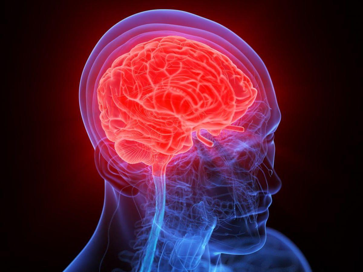 Une Américaine reçoit un implant dans le cerveau pour atténuer ses troubles obsessionnels compulsifs et son épilepsie Une Américaine reçoit un implant dans le cerveau pour atténuer ses troubles obsessionnels compulsifs et son épilepsie