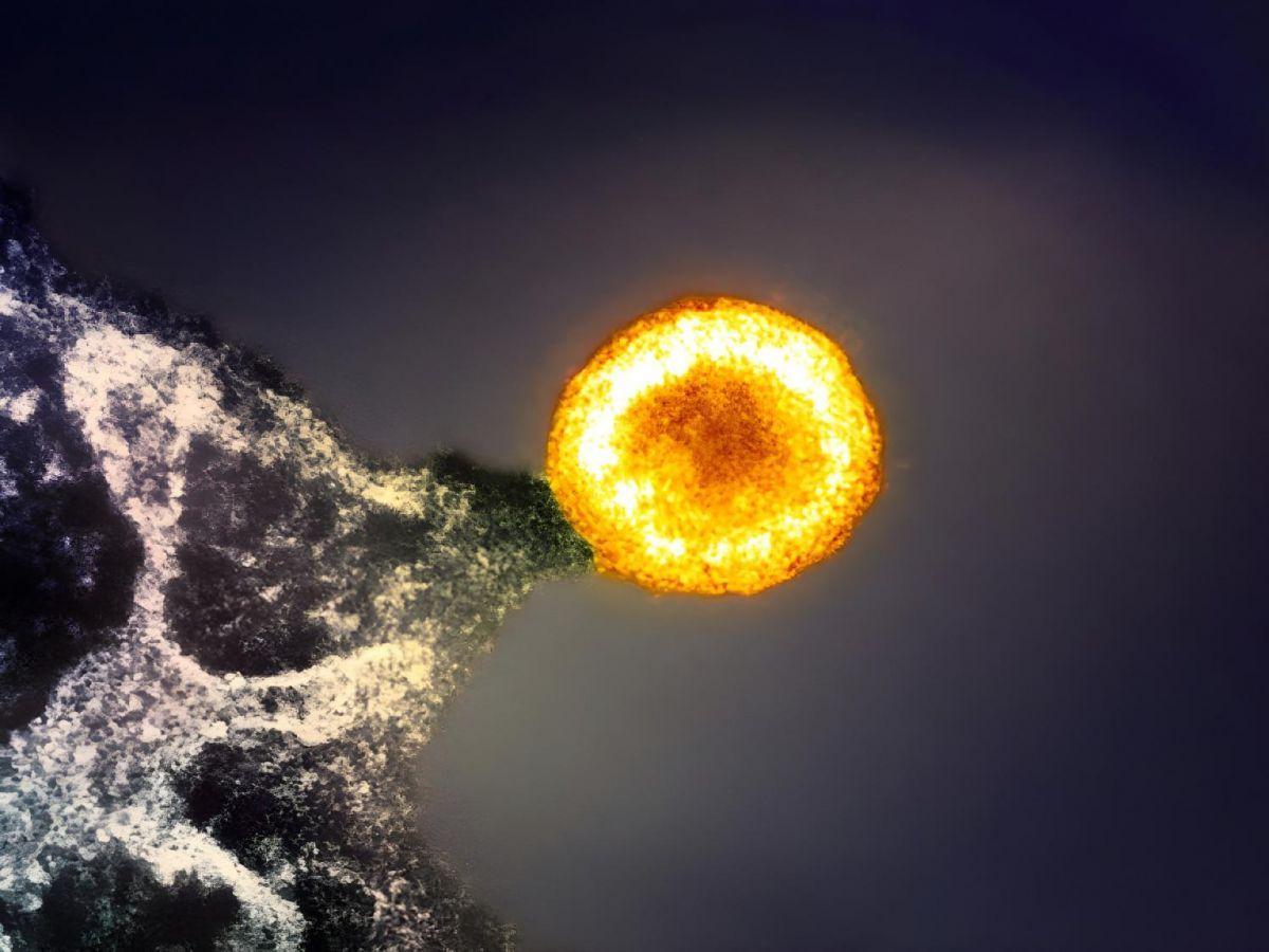 Patients Sida: vers un Statut de ContrôLeurs du Virus Patients Sida: vers un Statut de ContrôLeurs du Virus