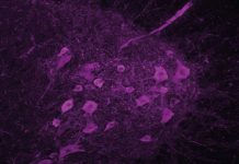 Maladie de Charcot: Troubles du Sommeil Précèdent Moteurs Maladie de Charcot: Troubles du Sommeil Précèdent Moteurs