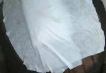 Activiste Blessé à Cap Estérias lors d’un Conflit Foncier Activiste Blessé à Cap Estérias lors d'un Conflit Foncier