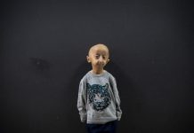 Gène de Centenaires Contre la Progéria Rarissime Gène de Centenaires Contre la Progéria Rarissime