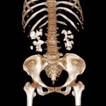 Découverte Inattendue Sur Les Calculs Rénaux Découverte Inattendue Sur Les Calculs Rénaux