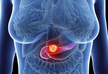 Cancer Du Pancréas Éliminé Chez La Souris Cancer Du Pancréas Éliminé Chez La Souris