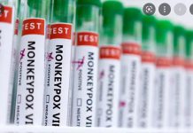 UK monkeypox symptoms different to prior outbreaks UK monkeypox symptoms different to prior outbreaks
