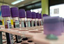 Report shows number of Monkeypox cases in Cork Report shows number of Monkeypox cases in Cork