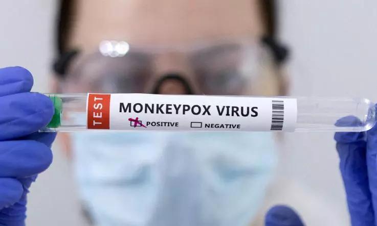 Monkeypox alert: Traveller from West Africa detected for new strain of virus, reports UK
https://www.news9live.com/health/health-conditions/monkeypox-alert-traveller-from-west-africa-detected-for-new-strain-of-virus-reports-uk-193596 Monkeypox alert: Traveller from West Africa detected for new strain of virus, reports UK https://www.news9live.com/health/health-conditions/monkeypox-alert-traveller-from-west-africa-detected-for-new-strain-of-virus-reports-uk-193596