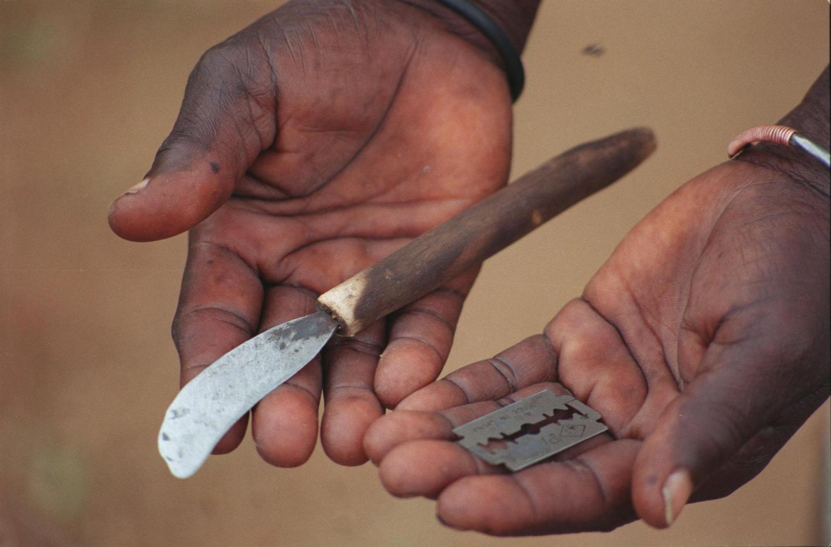 FGM or female circumcision should remain criminalised FGM or female circumcision should remain criminalised
