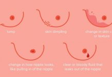 Breast cancer is not a spiritual disease – Dr Ackon Breast cancer is not a spiritual disease – Dr Ackon