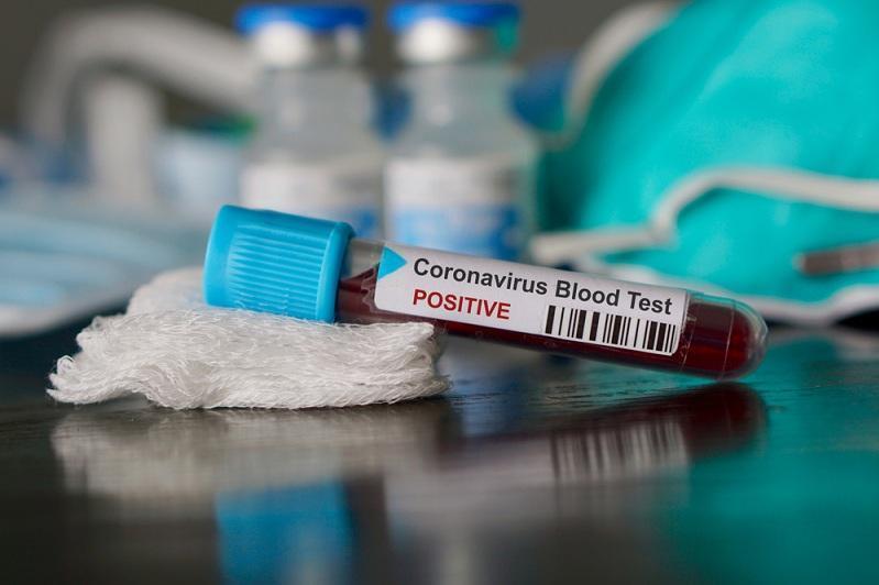 Russia detects 33,389 daily COVID-19 cases, crisis center says
Все права защищены. Используйте активную ссылку на inform.kz https://www.inform.kz/en/russia-detects-33-389-daily-covid-19-cases-crisis-center-says_a3869546 Russia detects 33,389 daily COVID-19 cases, crisis center says Все права защищены. Используйте активную ссылку на inform.kz https://www.inform.kz/en/russia-detects-33-389-daily-covid-19-cases-crisis-center-says_a3869546