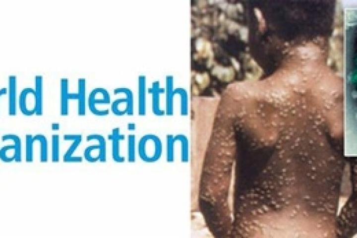 Mayor of Accra admonishes residents to stop dumping refuse into drains Mayor of Accra admonishes residents to stop dumping refuse into drains