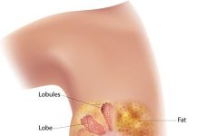 Breast Cancer Education Should Be Intensified in Rural Communities – Clinical Oncologist Breast Cancer Education Should Be Intensified in Rural Communities - Clinical Oncologist