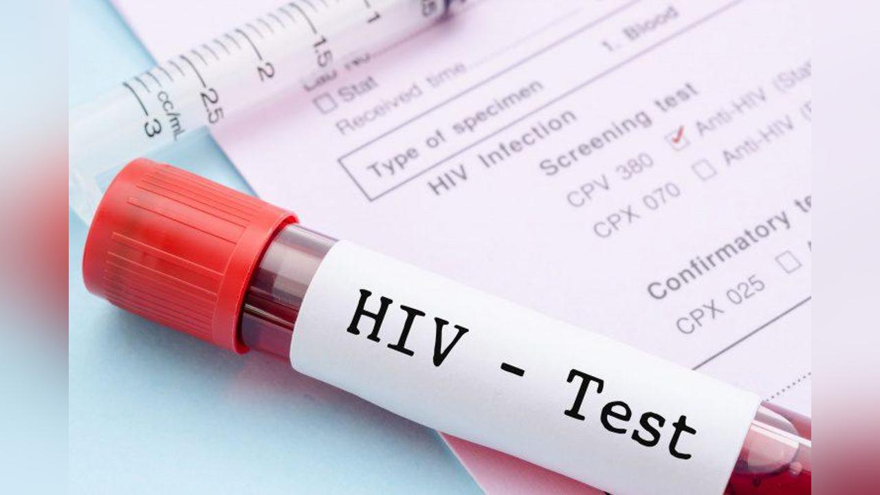 US$86 million needed to eliminate HIV/AIDS by 2030 US$86 million needed to eliminate HIV/AIDS by 2030