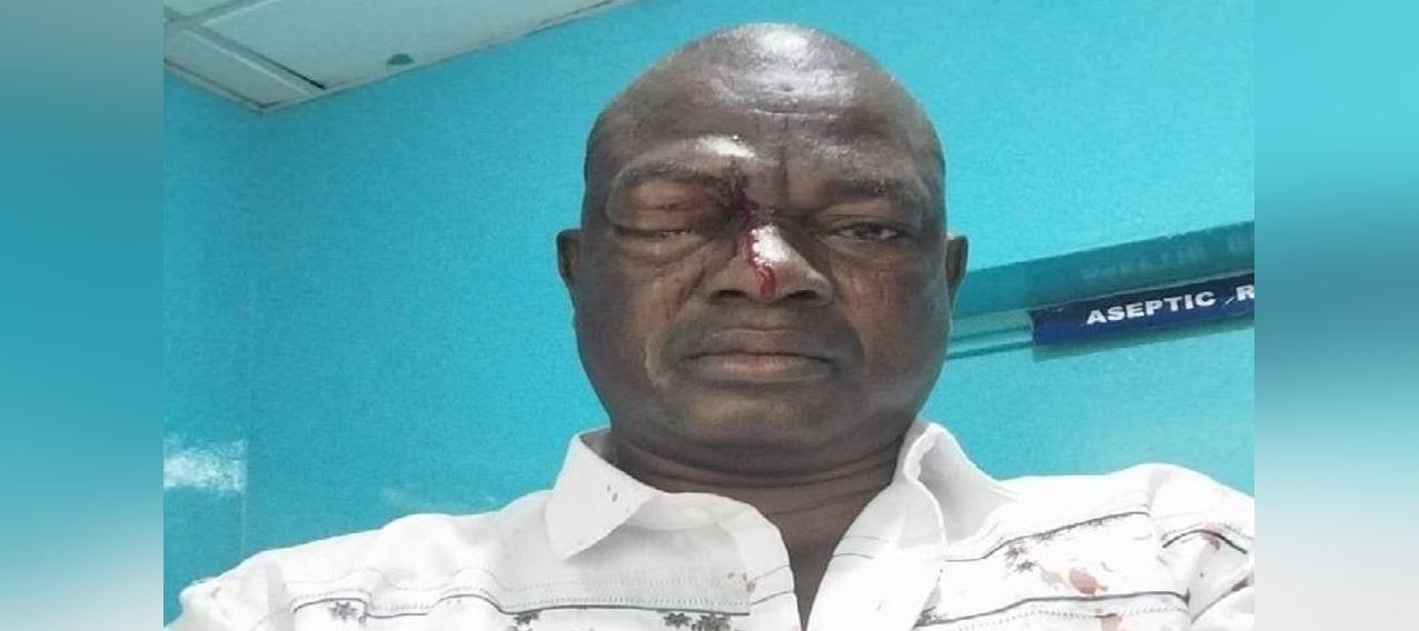 Doctors say the pupil of Alan’s assaulted polling agent has shifted – Nyamah Doctors say the pupil of Alan’s assaulted polling agent has shifted – Nyamah