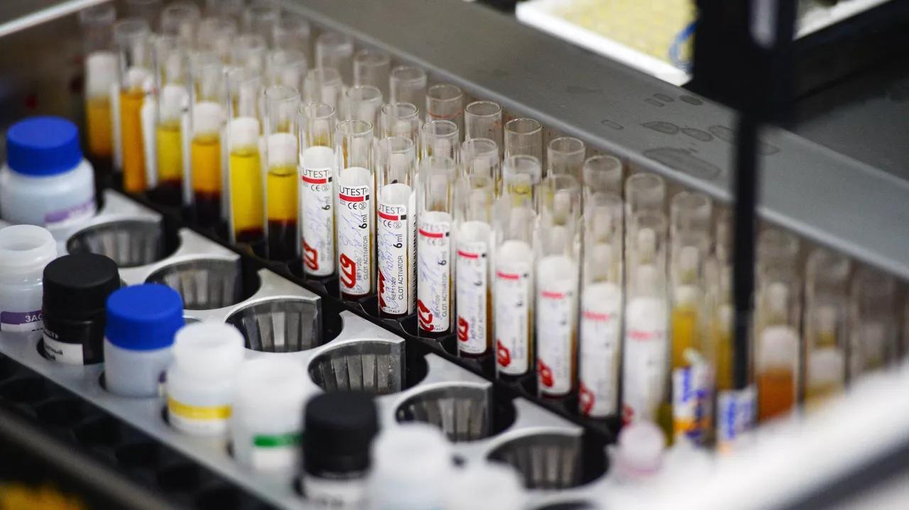 Russia Concerned US May Be Expanding Biolab Network in Africa: Foreign Ministry Russia Concerned US May Be Expanding Biolab Network in Africa: Foreign Ministry