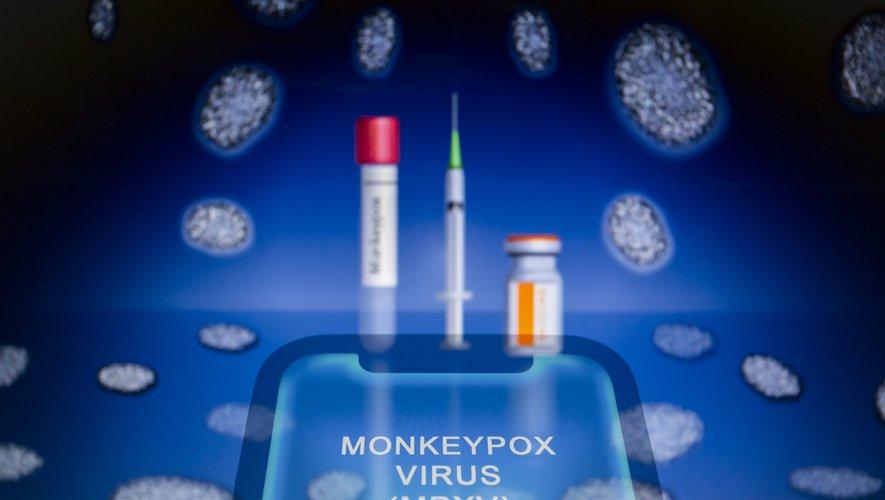 Variole du singe : un décès confirmé par l'OMS, plus de 2 000 cas dans le monde... le point sur la situation Variole du singe : un décès confirmé par l'OMS, plus de 2 000 cas dans le monde... le point sur la situation