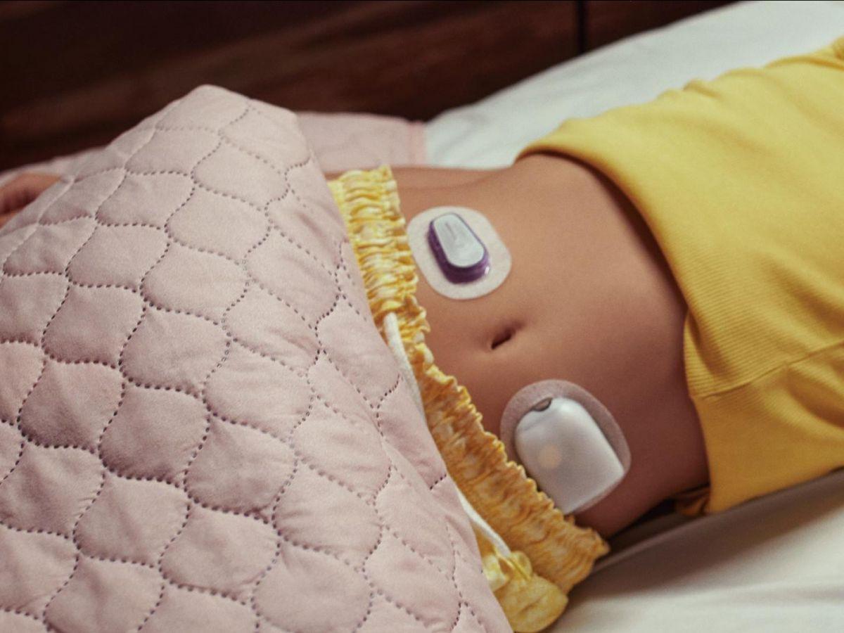 Diabète : le pancréas artificiel est aussi utile chez les très jeunes enfants Diabète : le pancréas artificiel est aussi utile chez les très jeunes enfants