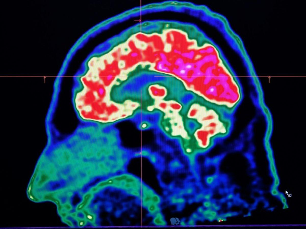 Des chercheurs “décodent” les pensées grâce à l’imagerie cérébrale et l’intelligence artificielle Des chercheurs “décodent” les pensées grâce à l’imagerie cérébrale et l’intelligence artificielle