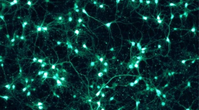 Rôle de la Dopamine dans L’Apprentissage et le Plaisir Rôle de la Dopamine dans L’Apprentissage et le Plaisir