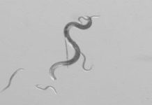 Qu’Est-Ce que le Nématode du Pin, qui Envahit les Landes? Qu’Est-Ce que le Nématode du Pin, qui Envahit les Landes?