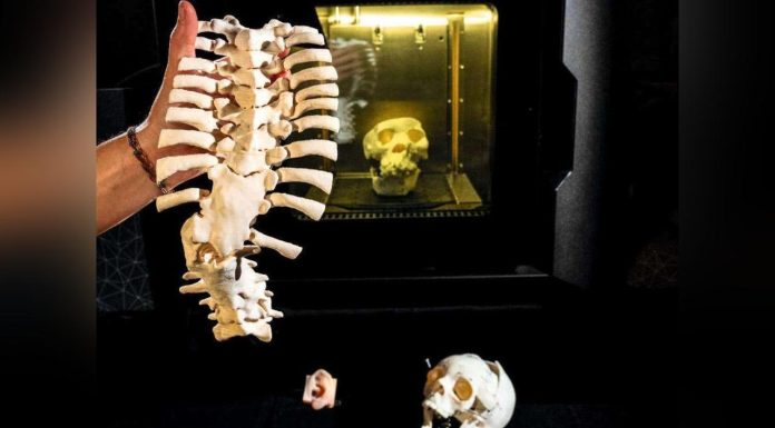 HôPital: L’Impression 3D pour une Médecine de Précision HôPital: L’Impression 3D pour une Médecine de Précision