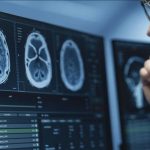 IRM Cérébrale: IA Améliore Détection des Anomalies IRM Cérébrale: IA Améliore Détection des Anomalies