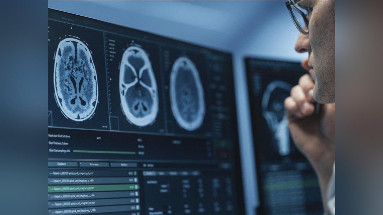 IRM Cérébrale: IA Améliore Détection des Anomalies IRM Cérébrale: IA Améliore Détection des Anomalies