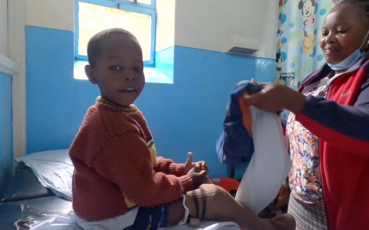 Joy for mother whose baby lost both legs after birth Joy for mother whose baby lost both legs after birth