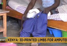 Kenyan company becomes country’s first to 3D print prosthetic limbs Kenyan company becomes country’s first to 3D print prosthetic limbs