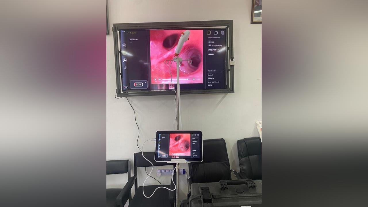 Sakaja lauds medics as Mama Lucy Hospital conducts first bronchoscopy Sakaja lauds medics as Mama Lucy Hospital conducts first bronchoscopy