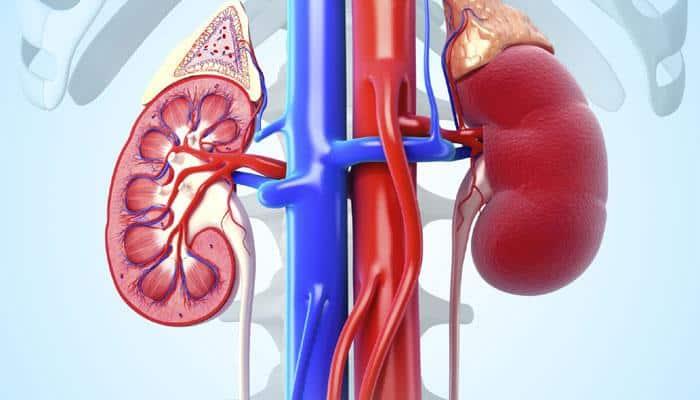 kidney-health-for-all-lesotho