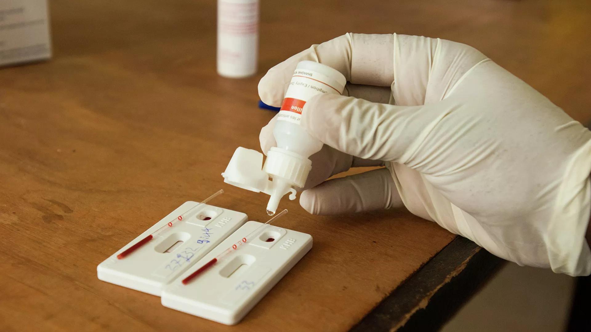 Far More Dangerous & Contagious HIV Variant Discovered in The Netherlands, Study Shows Far More Dangerous & Contagious HIV Variant Discovered in The Netherlands, Study Shows