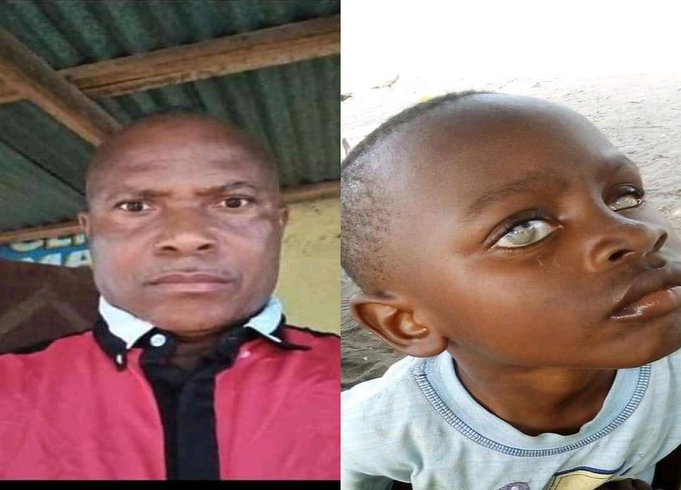 Liberia: Nurse License Suspended for Performing Eye Surgery – A Practice Beyond His Scope Resulting to Damage of Child’s Eye Liberia: Nurse License Suspended for Performing Eye Surgery – A Practice Beyond His Scope Resulting to Damage of Child’s Eye