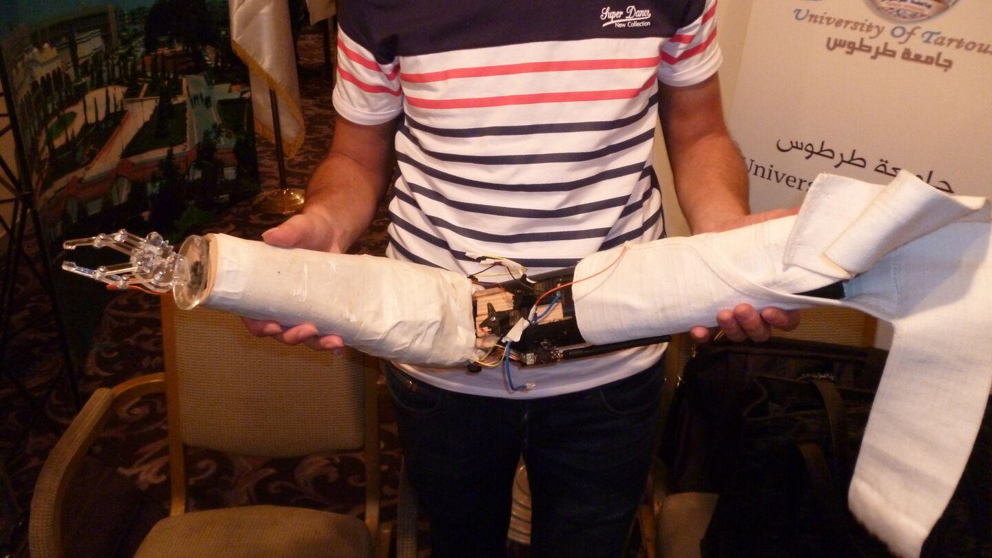 تقنية جديدة تتيح الشعور بالحرارة لأصحاب الأطراف الصناعية... فيديو تقنية جديدة تتيح الشعور بالحرارة لأصحاب الأطراف الصناعية... فيديو