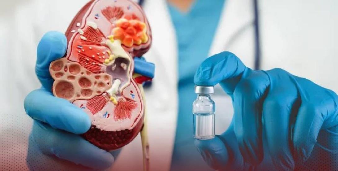 تجربة واعدة بعمليات زرع الأعضاء.. علماء ينجحون بتغيير دم كلى
