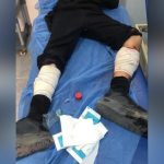 إصابة 4 أطفال في انفجار من مخلفات الحرب بعين زارة في طرابلس إصابة 4 أطفال في انفجار من مخلفات الحرب بعين زارة في طرابلس