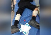 إصابة 4 أطفال في انفجار من مخلفات الحرب بعين زارة في طرابلس إصابة 4 أطفال في انفجار من مخلفات الحرب بعين زارة في طرابلس