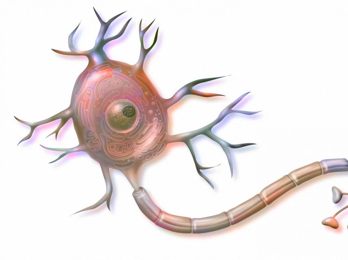 Comment le gène APOE4 agit sur le cholestérol et peut déclencher la maladie d’Alzheimer Comment le gène APOE4 agit sur le cholestérol et peut déclencher la maladie d’Alzheimer